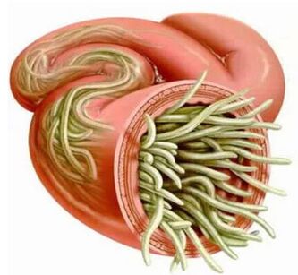 Human parasites symptoms and treatment
