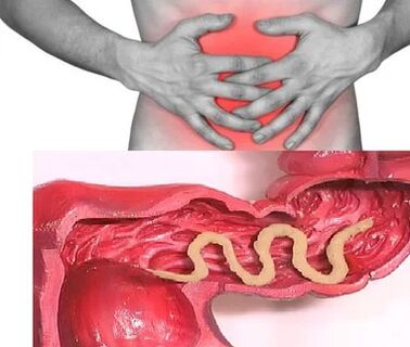 Human parasites