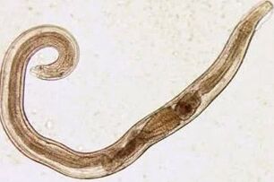 Parasites of a man of cuts