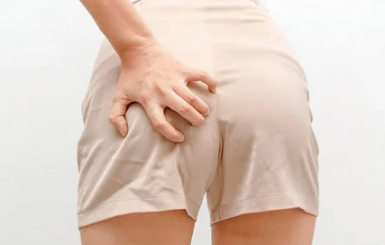 Anal itch