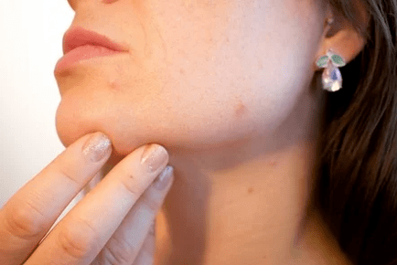 Skin problems