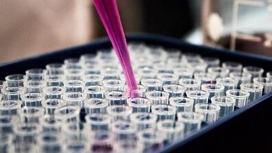 How to do tests for the detection of parasites in the body